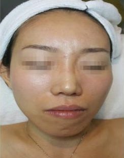 After BB COVERED e1533616579728 After BB COVERED e1533616579728