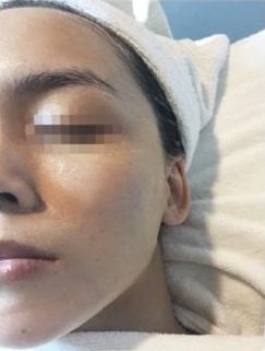 After COLLAGEN 2