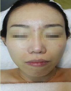 Before BB COVERED e1533616564193 Before BB COVERED e1533616564193