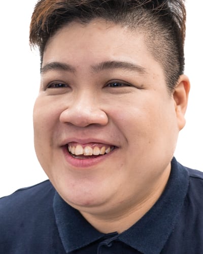 Before LED Teeth Whitening