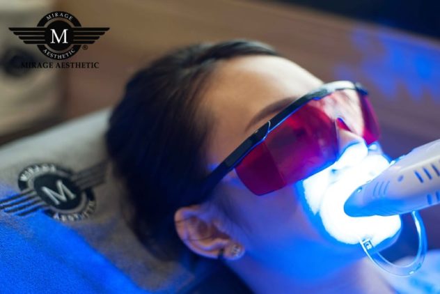 Teeth Whitening