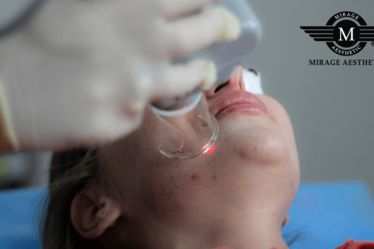 Benefits of Acne Scar Treatment