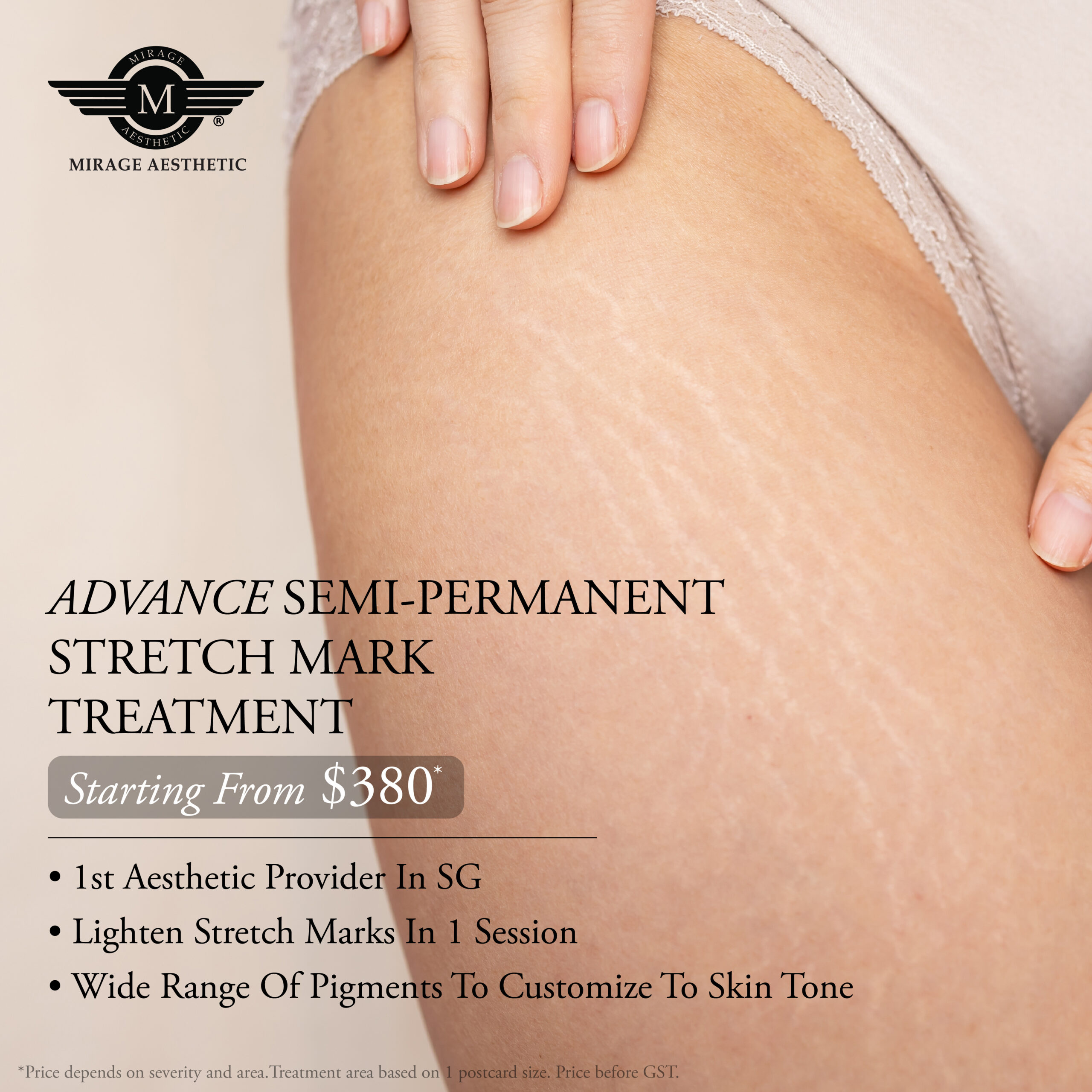 stretch mark
