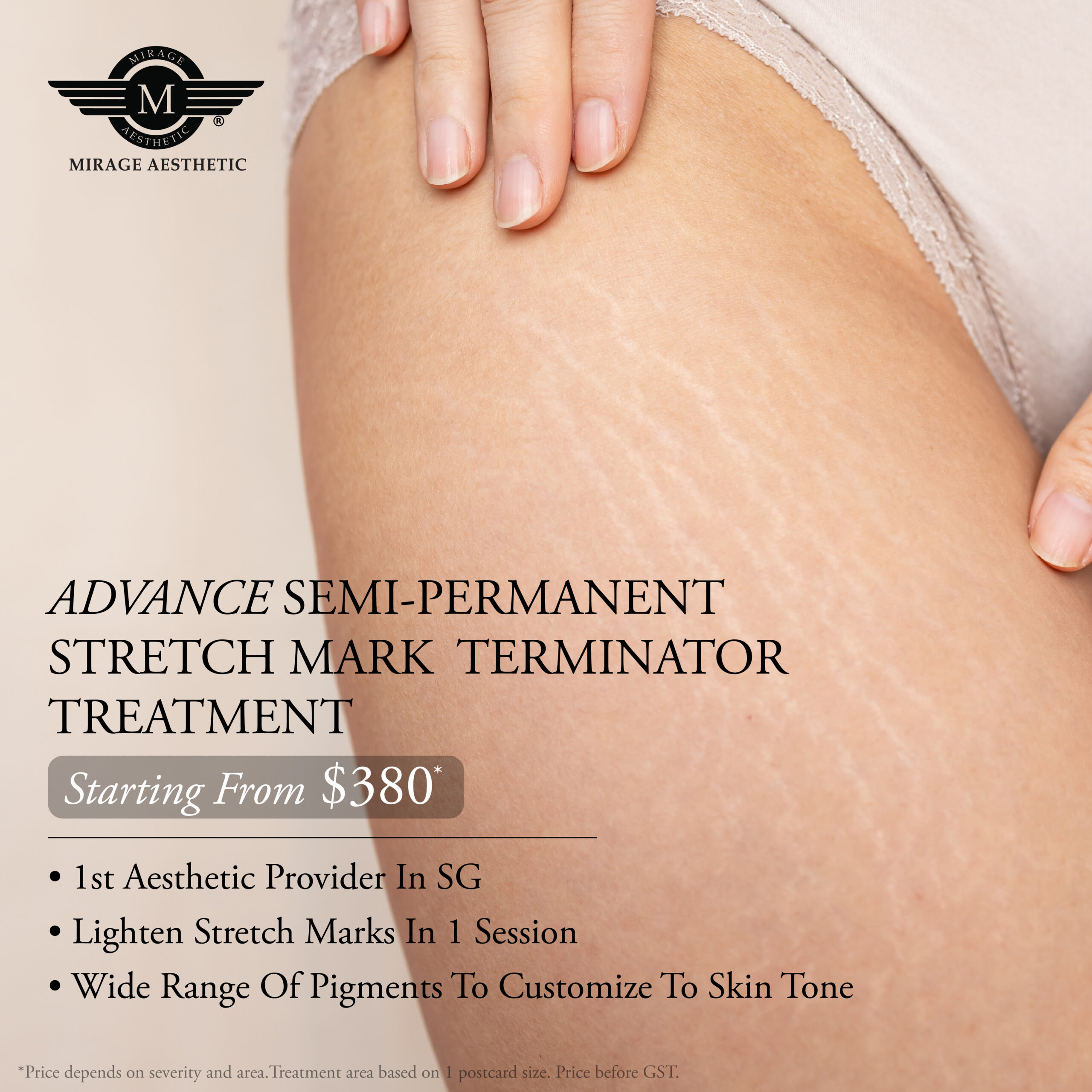 stretch mark