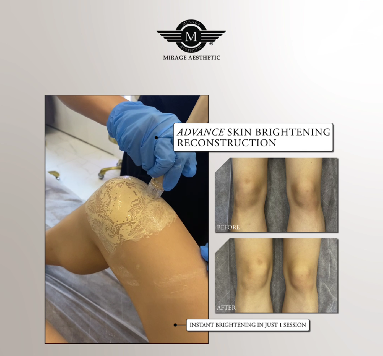 ee glow knee