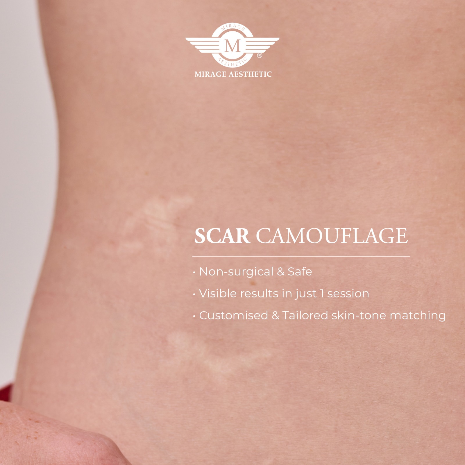 scar camouflage