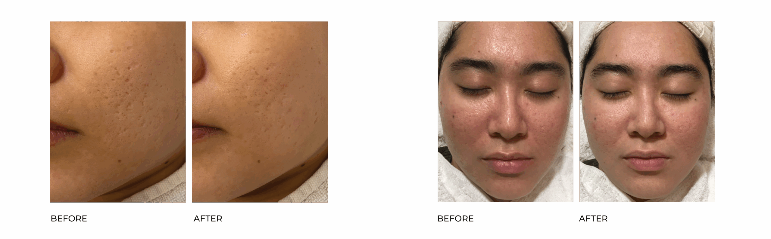 VIVA FRACTIONAL BA 26
