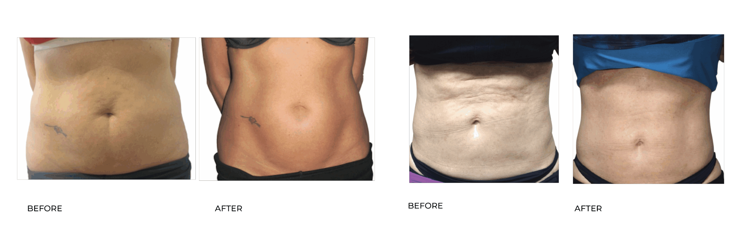 bodyfit BA 13
