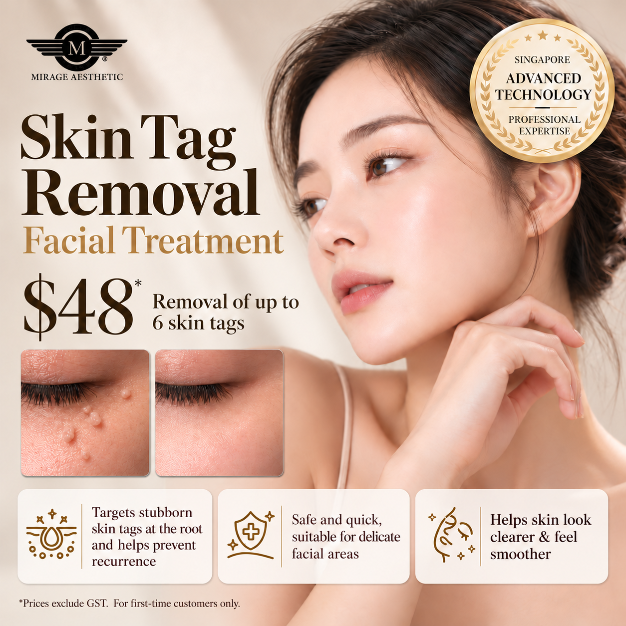 Skin Tag Removal Ad Benefit Update